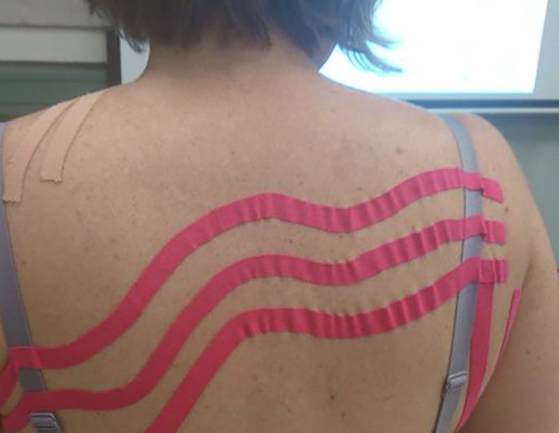 kinesiology tape on upper back for lymphatic drainage