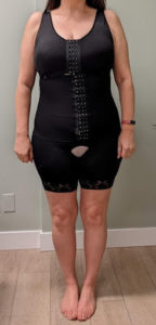 front view of the faja compression garment